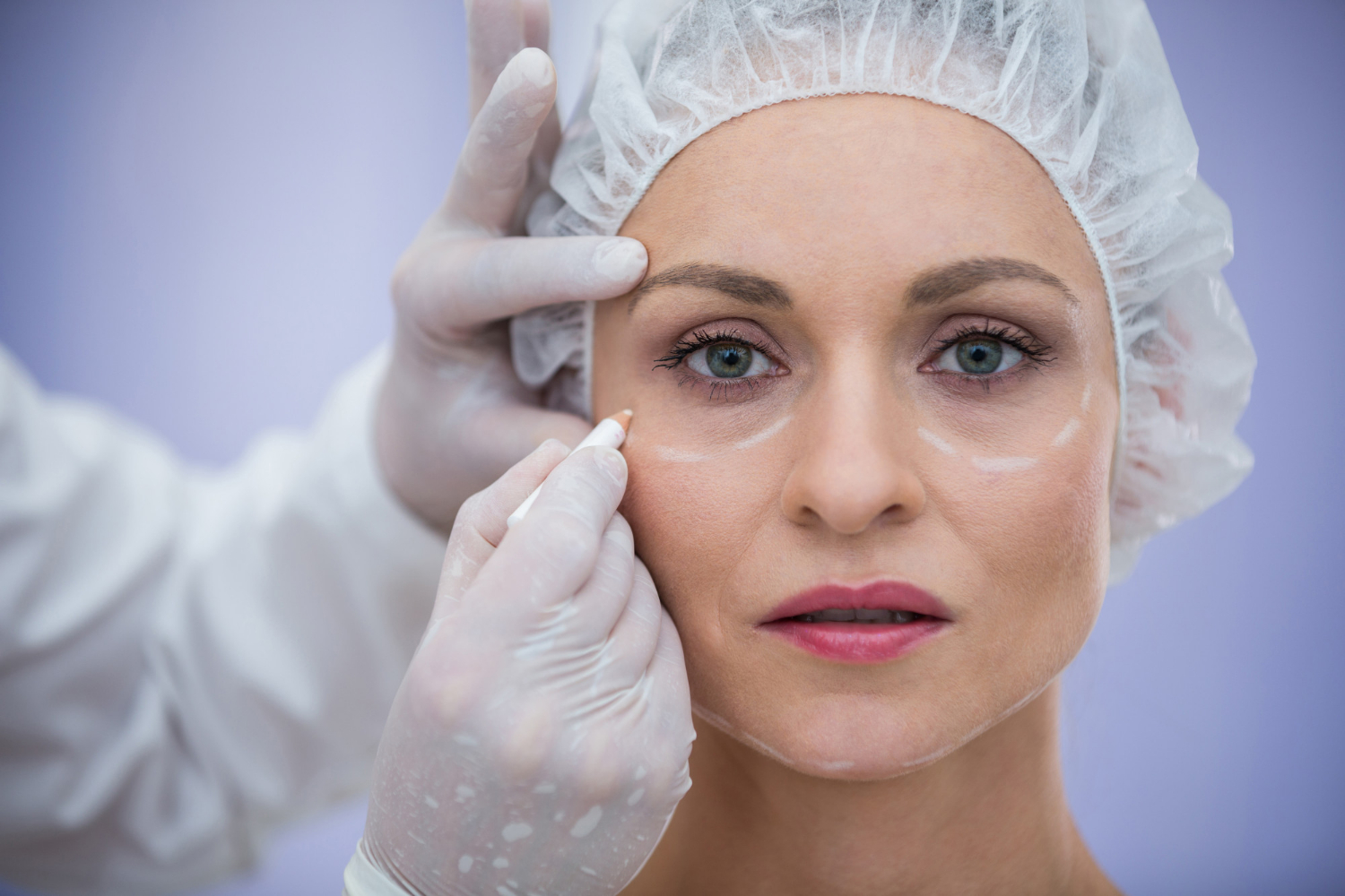 Eyelid Surgery cost in Ahmedabad